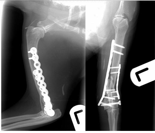 12-weeks post-operative radiographs